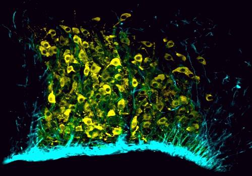 supraoptic nucleus